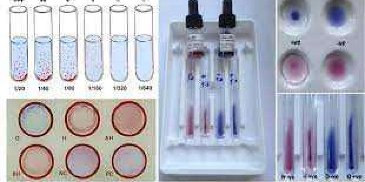 Typhoid Antibody Testing Market to be Propelled by Rising Number of Cases of the Disease in Developing Countries; Market