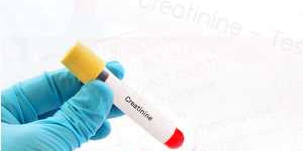 Creatinine Test Market Analysis By Industry Value, Market Size,by 2030