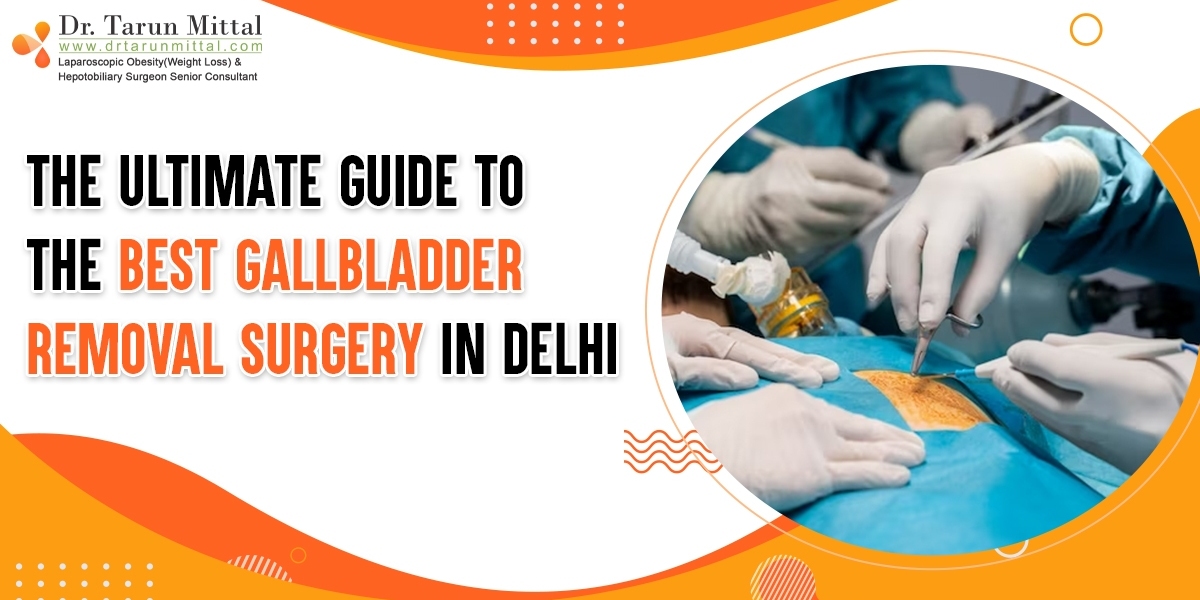 Best Gallbladder Removal Surgery in Delhi
