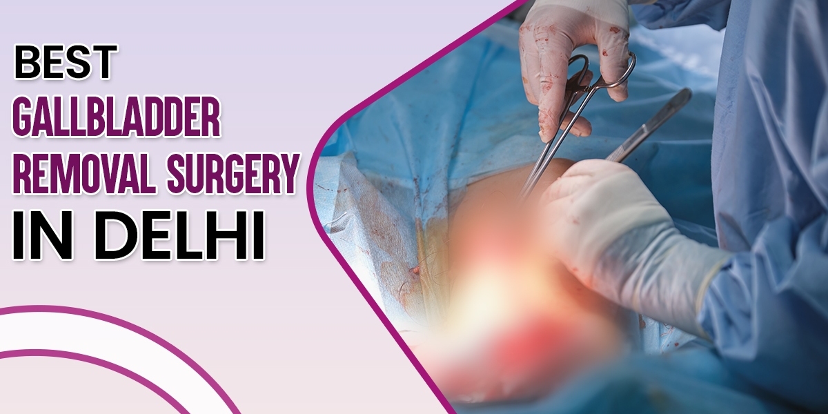 Best Gallbladder Removal Surgery in Delhi - Expert Care, Affordable Options