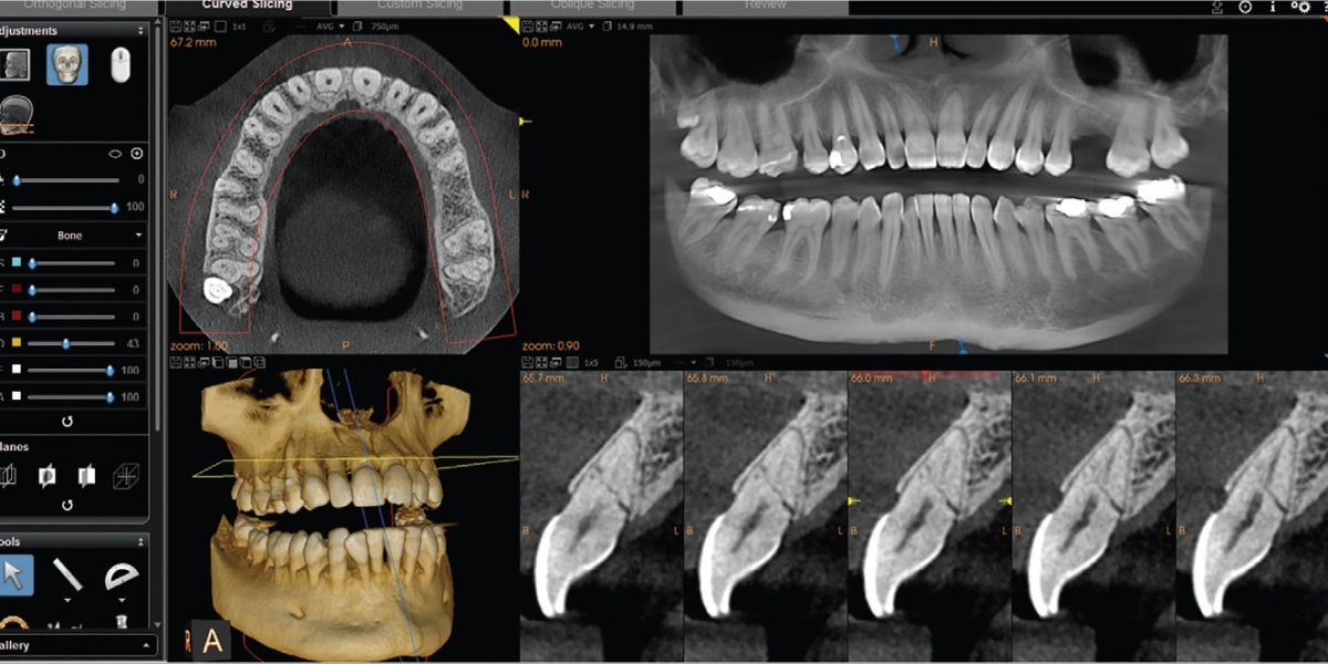 CBCT Dental Imaging Market Share to Benefit from the Technologically Modern Solutions