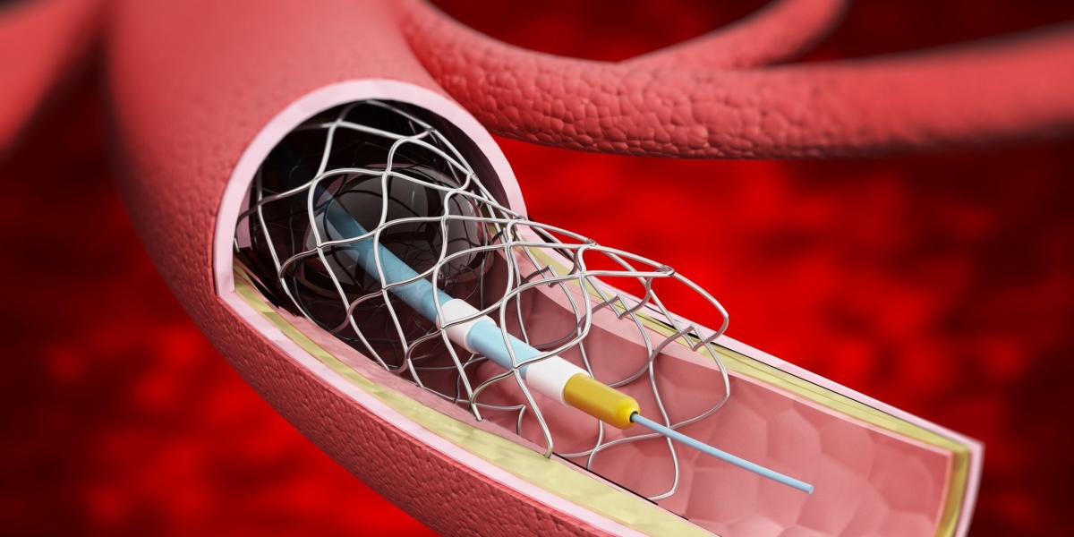 Global Industry to Register approx. 7.40% CAGR during 2022-2030; Asserts Vascular Stents Market Insights