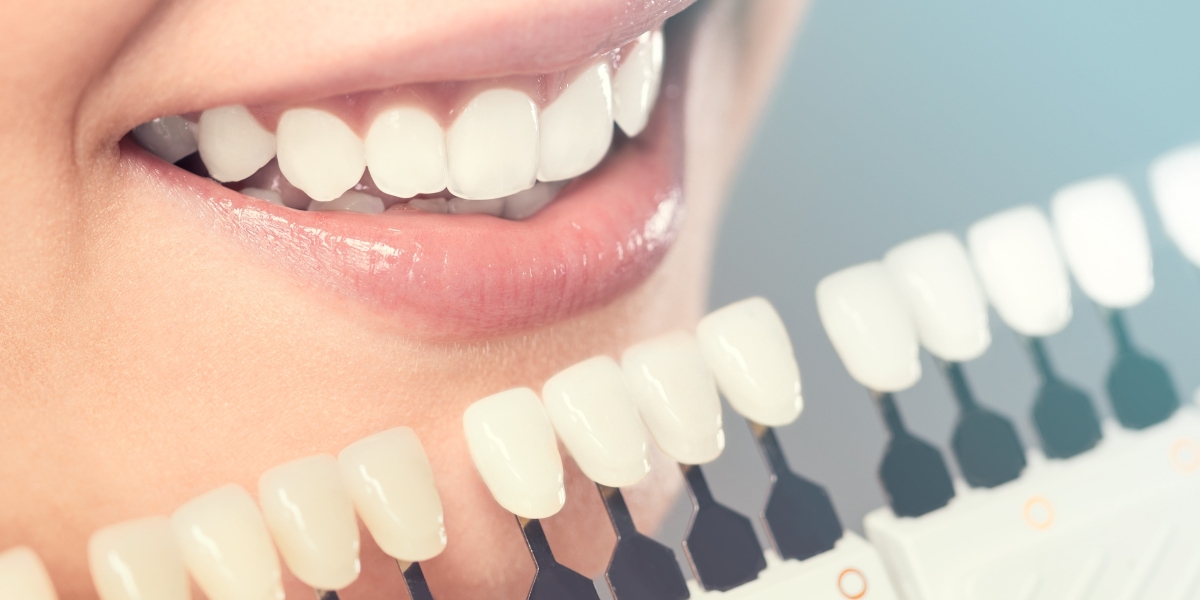 Gum Contouring Cost: Understanding the Investment in a Beautiful Smile