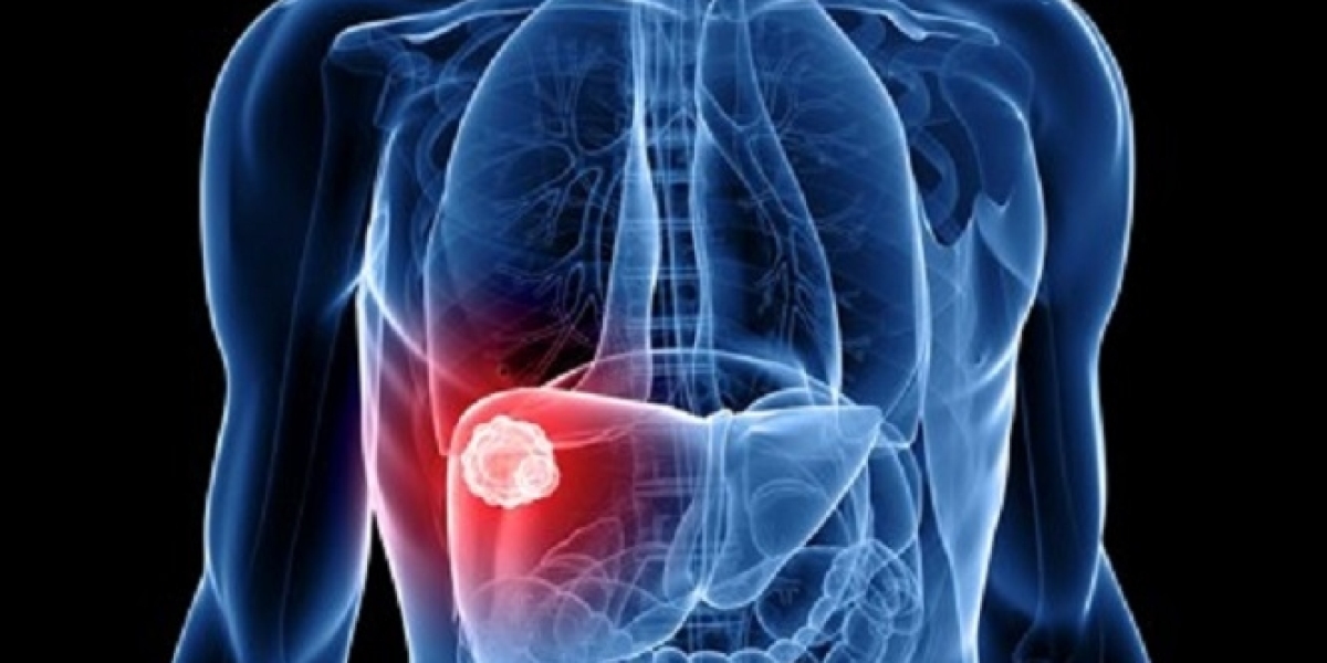 Advanced Liver Cancer Market Report: Epidemiology, Trends and Forecast to (2024-2034)