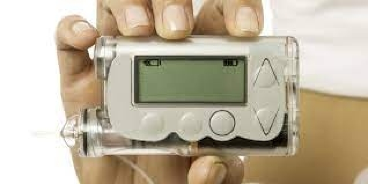 "Continuous Glucose Monitoring: Advancements and Challenges"