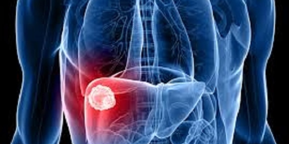 Cholangiocarcinoma Market Size, Trends And Forecast To 2034