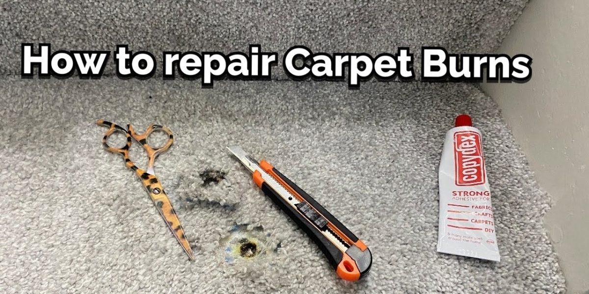 A Step-by-Step Guide to Making Carpet Burns Disappear