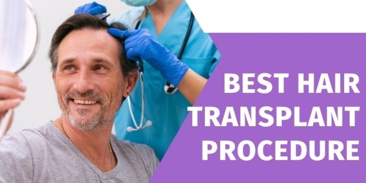 The Future of Follicles: Choosing the Best Hair Transplant Procedure