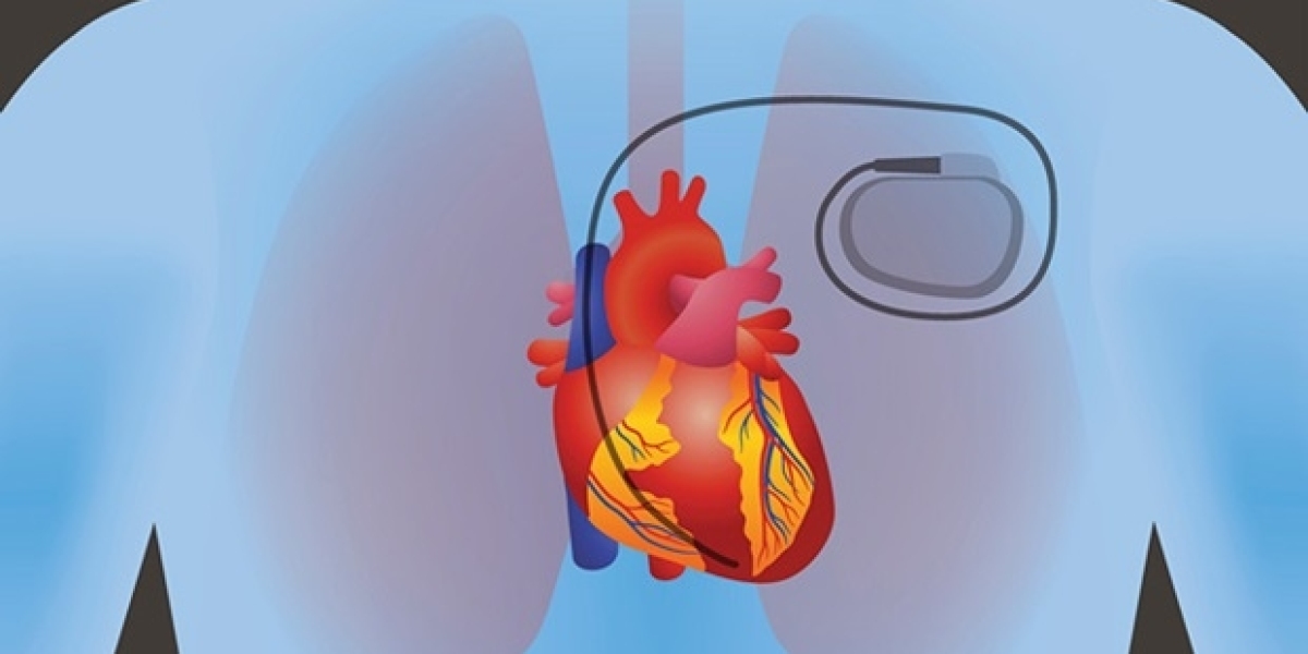 Cardiac Pacemaker Market is Anticipated to Witness High Growth Owing to Rising Geriatric Population