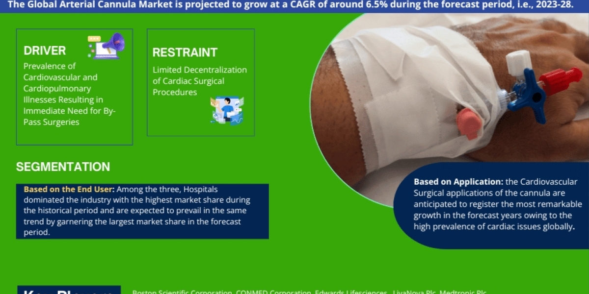 Thị trường ống thông động mạch sẽ đạt tốc độ CAGR đáng chú ý là 6,5% vào năm 2028, Quy mô, Chia sẻ, Xu hướng, Động lực c