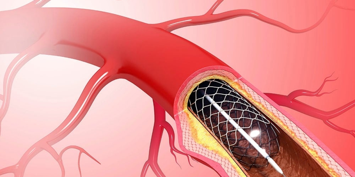 Peripheral Vascular Devices: Revolutionizing Circulatory Care