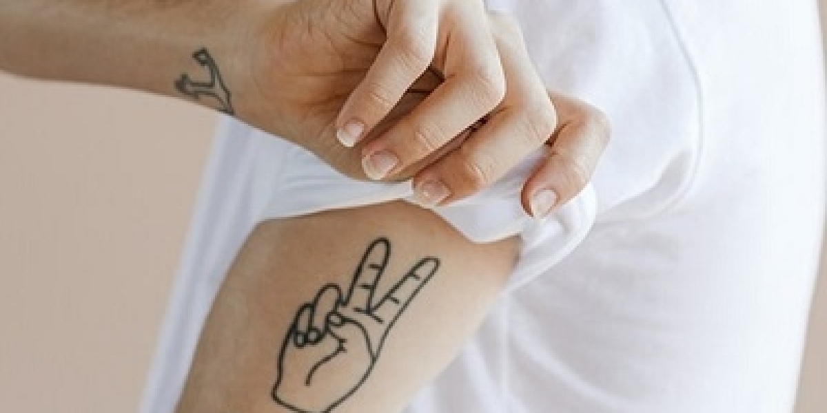 7 Things to Know Before Getting PicoSure Tattoo Removal in Dubai