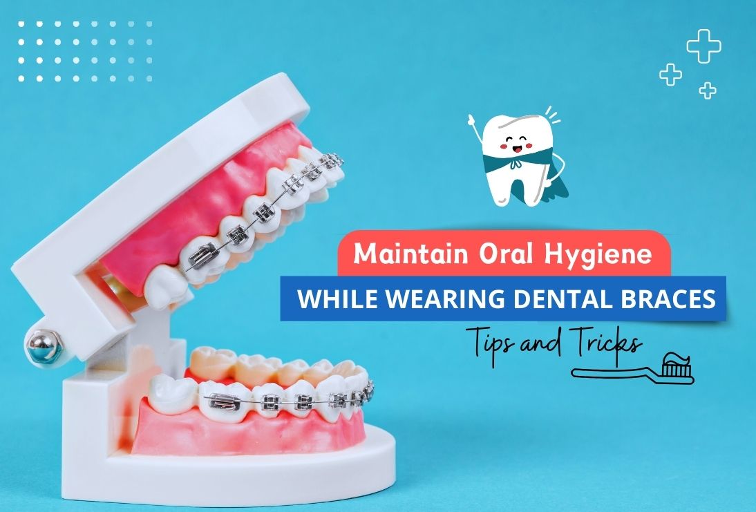 How to Maintain Oral Hygiene While Wearing Dental Braces: Tips and Tricks | Teethcare
