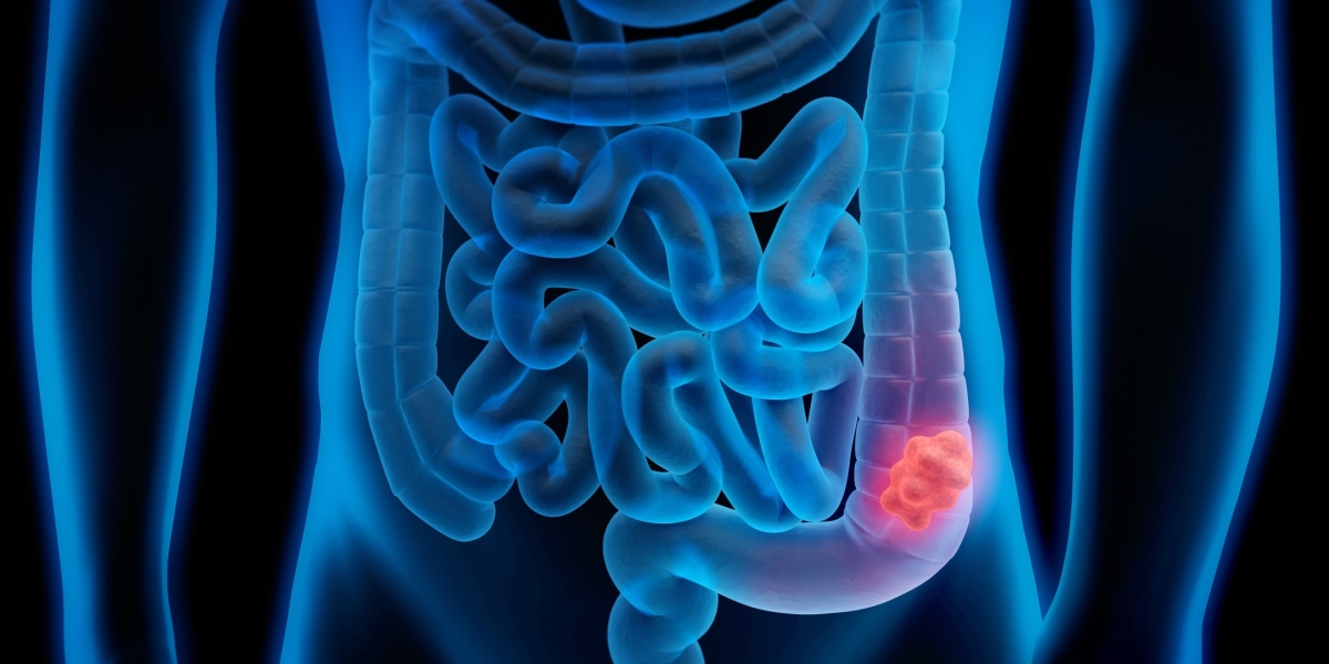 The U.S. Colorectal Cancer Screening Market will grow at highest pace owing to increasing number of screening procedures