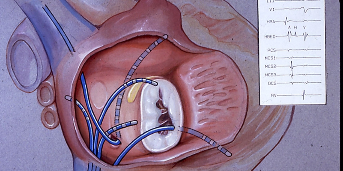 Electrophysiology Devices Market: Key Players and Strategies